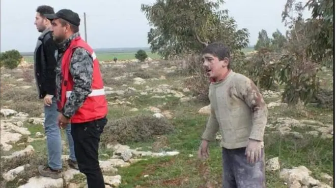 بعض الجرحى نتيجة القصف التركي على أطراف مدينة عفرين في 21/01/2018