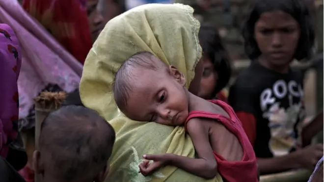 Seorang perempuan pengungsi Rohingya datang ke kamp pengungsian di Cox's Bazar, Bangladesh, membawa anaknya yang sakit.