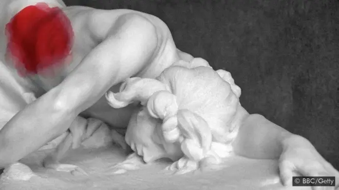 De nombreux cas rejetés comme "hystérie", dans lesquels les symptômes comprenaient des convulsions dues à la douleur, pourraient bien être des endométrioses