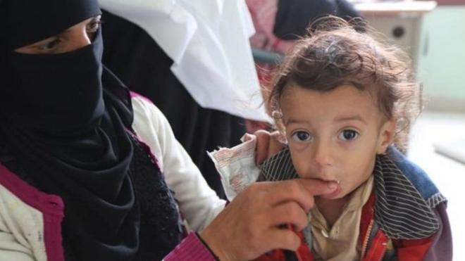 المنظمات الإنسانية "تخسر معركتها ضد المجاعة" في اليمن