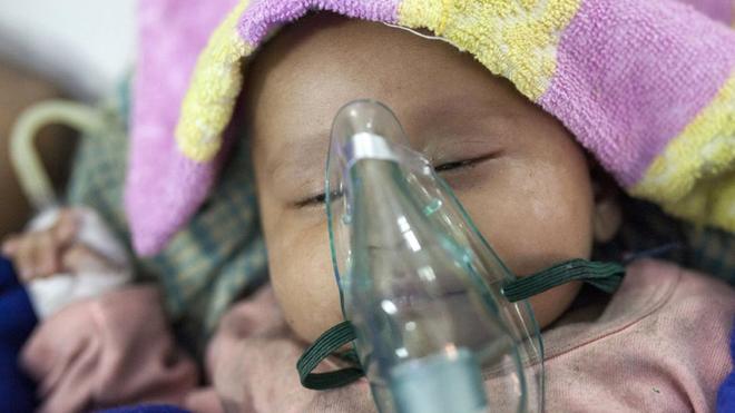 Un bebé con neumonía es nebulizado en Bangladesh