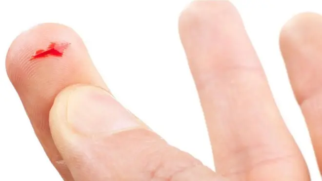 Una persona con una herida provocada por un papel en el dedo