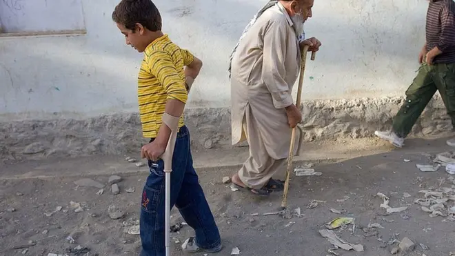 ګوزڼ واکسین