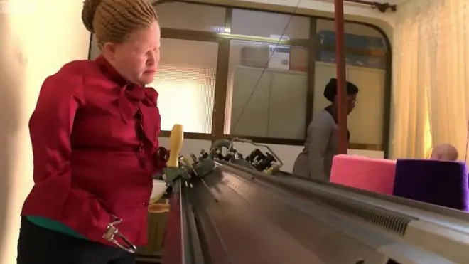 Albino's Hands Chopped Off