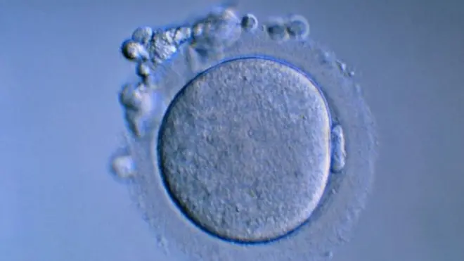 яйцеклетка