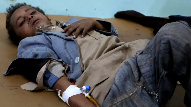 طفل يمني مصاب