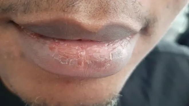 Egbugbere ọnụ kpọrọ nkụ