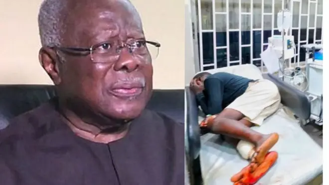 Bode George ati oluwọde to fara gbọgbẹ ni Lekki