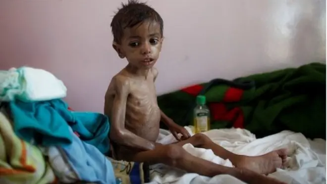 ብሕጽረት መግቢ ዝተሃስየ የመናዊ ህጻን