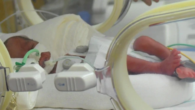 One of the nonuplets in an incubator in Casablanca, Morocco