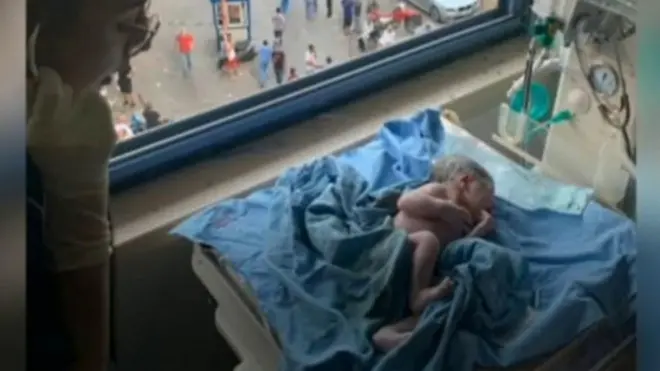 ولادة أثناء الانفجار