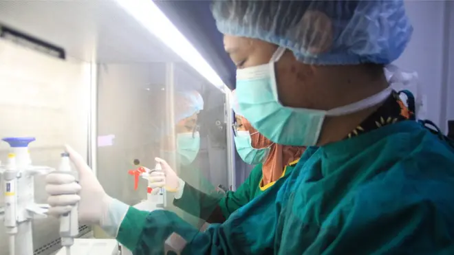 covid19, autoimun, lupus, obat, dexamethasone, virus corona