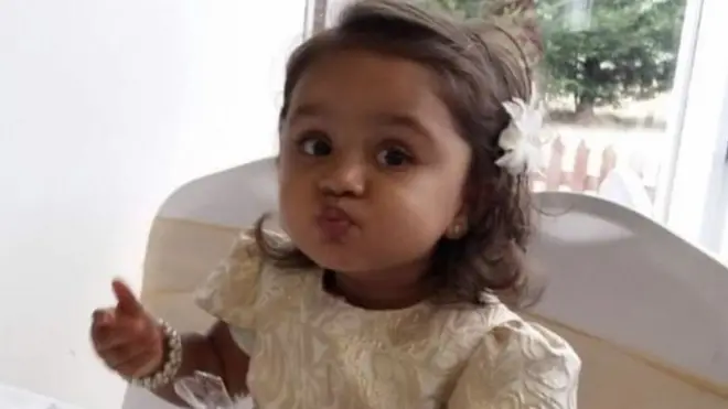 بچی کی دماغ کی رگیں پھٹ چکی ہیں