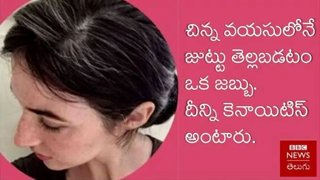 గ్రే హెయిర్