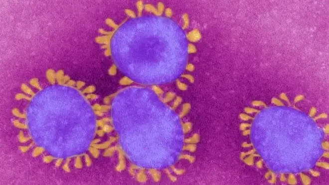 تنتطبق على فيروس كورونا مواصفات الوباء