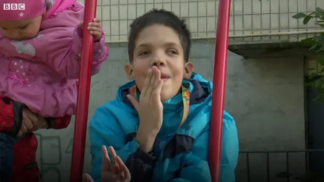 "Нам казали відмовитися від нього" - історія хлопчика з рідкісною хворобою