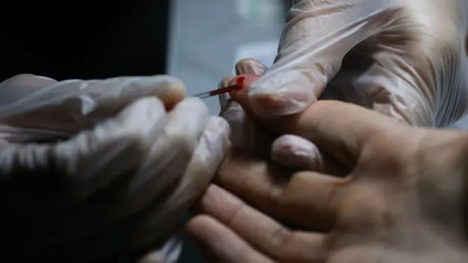 血液透析室產生感染的危險因素較多，易發生交叉感染。在疫情期間，如果有新冠病毒的攜帶者進行過血液透析，會導致機器染毒，這種情況下病毒的傳染性極高。