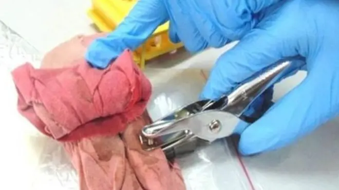 માસિક સ્ત્રાવમાં ઉપયોગમાં લેવાયેલા કપડાંઓ હેલ્થ વર્કરોએ એકત્રિત કર્યા