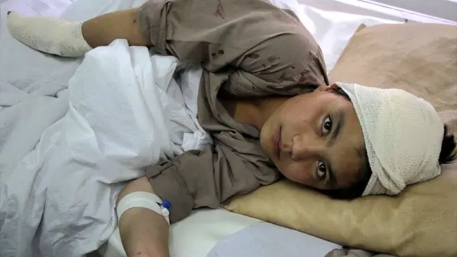 Afghan boy in hospital after a Taliban attack in Kabul, Afghanistan (19 April 2016)
