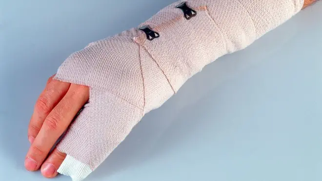 Ngay khi bạn phát hiện xương bị gãy, điều quan trọng là phải điều trị để đảm bảo xương sẽ lành đúng cách