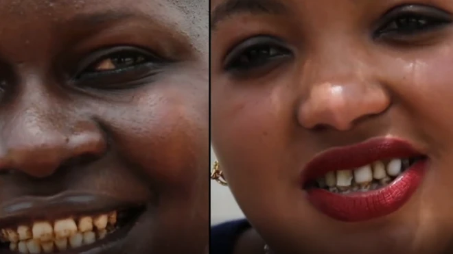 "மஞ்சள் பற்களால் என் கனவு சிதைந்துவிட்டது"