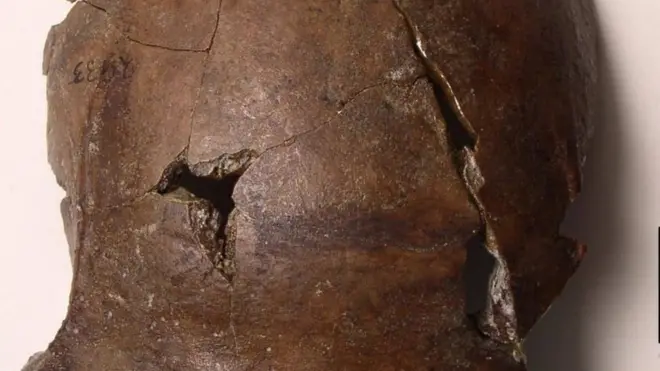 मानवी कवटी