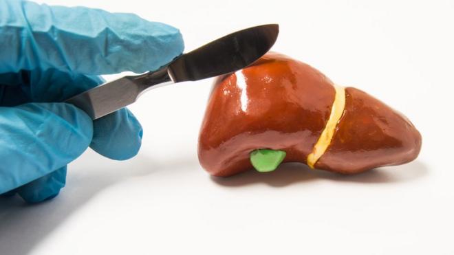 Жовчний міхур (на макеті позначений зеленим) - важливий орган, але не життєво необхідний