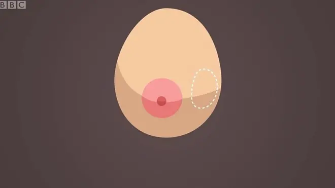 ภาพกราฟิกเต้านม