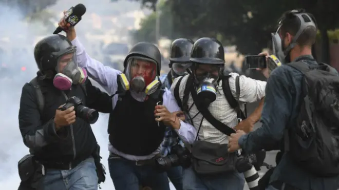 Imágenes de periodistas heridos durante protestas en Venezuela, un país que no registra tantas muertes, pero en el que cada vez resulta más peligroso informar.