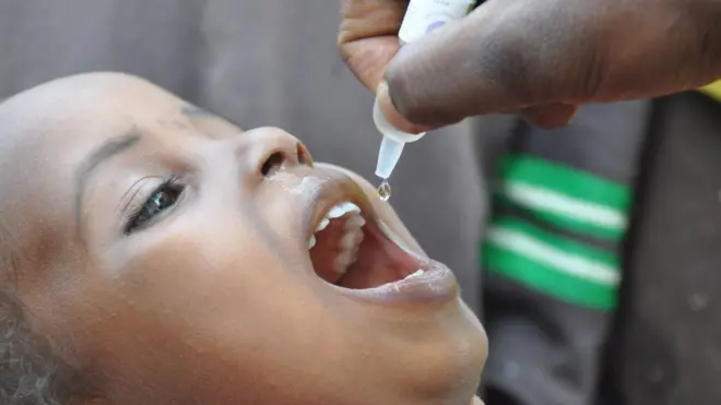 Imbasa (ubukangwe mu Kirundi) ni indwara ifite urukingo ruhabwa abana