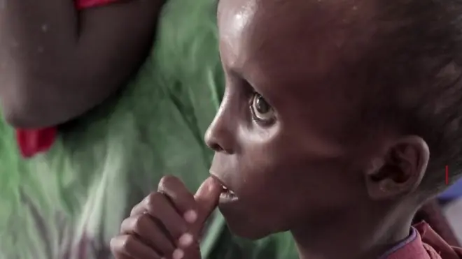 සෝමාලියාවේ මහා සාගතයක්