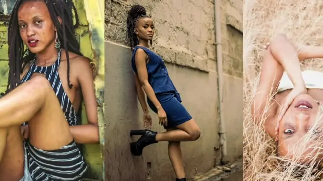 كانت كلوديا تبلغ من العمر 13 عاما عندما وقع تعرضت لحريق شوه وجهها ورقبتها