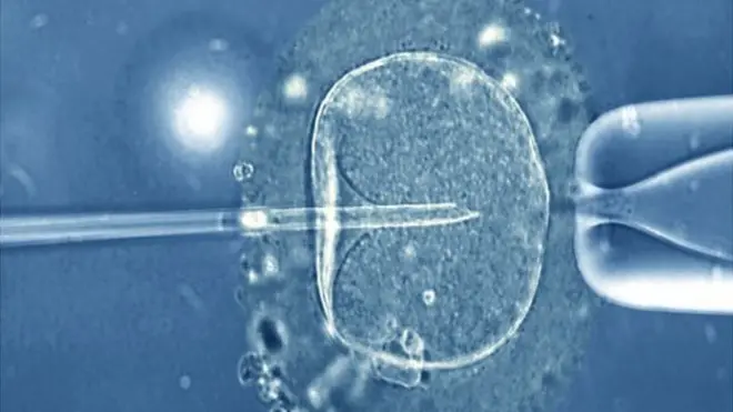 A human egg injected with a micro-needle that contains a single sperm