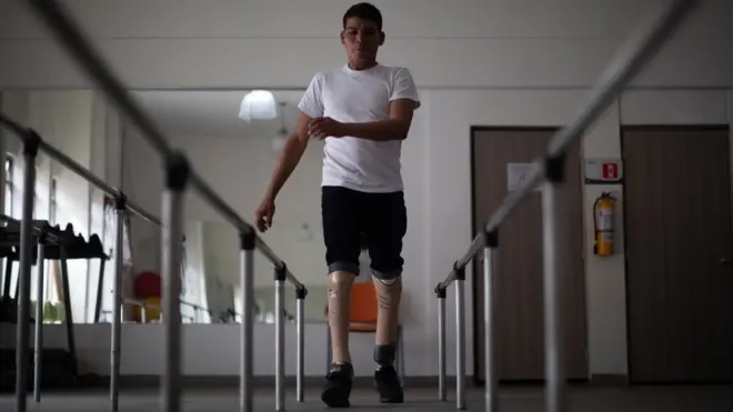 Al principio, con las piernas prostéticas caminaba como robotizado.