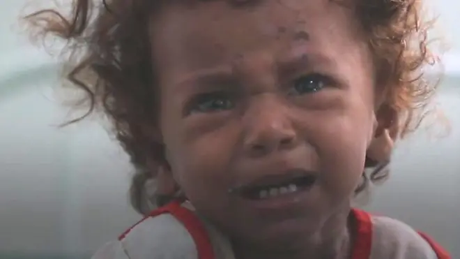 اليمن: معركة الحديدة نقطة تحول أم كارثة؟