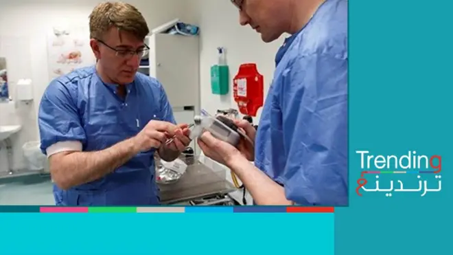 طبيب عراقي يبتكر قلبا اصطناعيا يحاكي القلب الطبيعي للإنسان