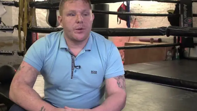 Ovaj momak je izgubio vid u ratu u Avganistanu