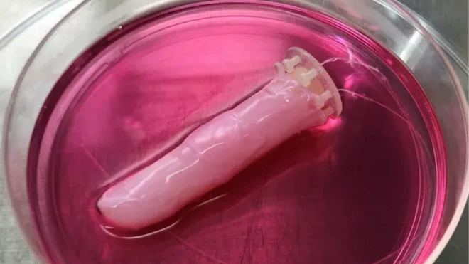 นิ้วหุ่นยนต์ที่หุ้มด้วย "ผิวหนังมีชีวิต" รักษาบาดแผลให้ตัวเองได้ด้วยพลาสเตอร์คอลลาเจน