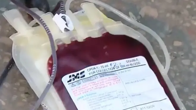 فيروس كورونا: نقص في أكياس الدم" في مصر"