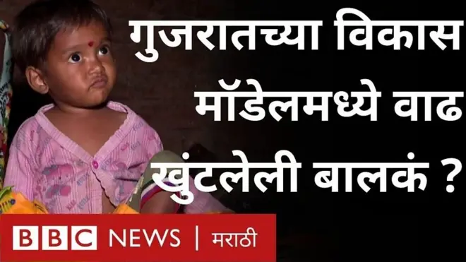 गुजरात, कुपोषित बालकं