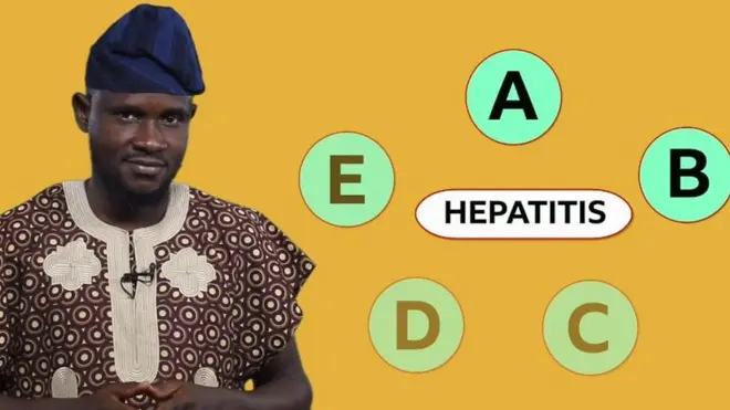 Hepatitis