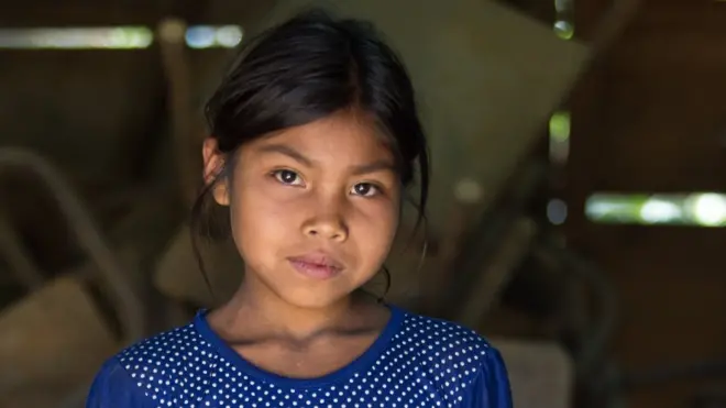 Sandra Magali vive en Chiquimula, Guatemala. A sus 9 años y tiene la estatura de una niña de 6.