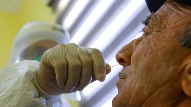 Covid-19, koronavirus, vaksin, peyvənd, Azərbaycanda koronavirus