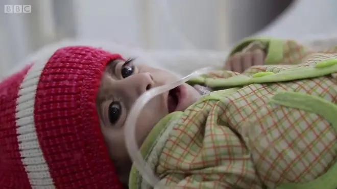 Ямандаги уруш туфайли оч қолаётган болалар