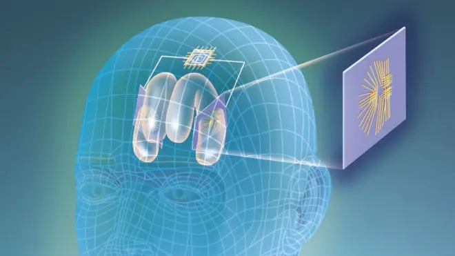 دماغ میں چپ