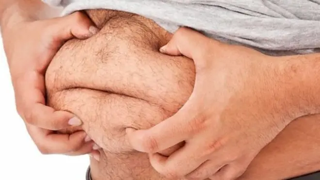 મેદસ્વિતા એક વૈશ્વિક સમસ્યા બની ગઈ છે