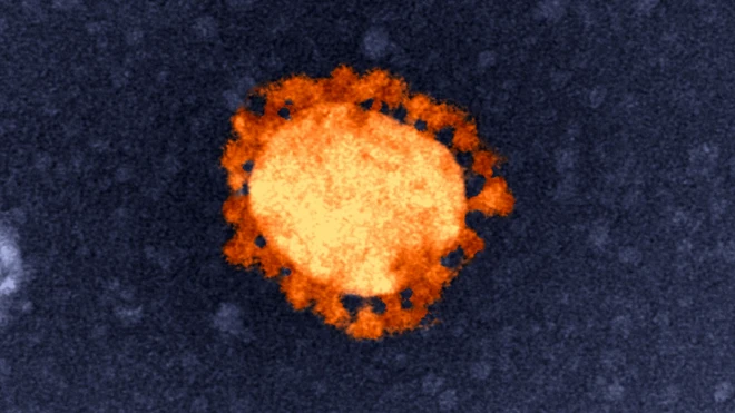 SARS CoV-2 is the virus which causes the disease Covid-19.