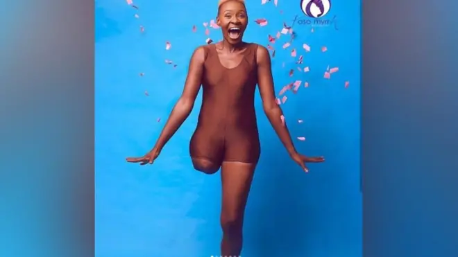 Why we be 'Amputee United'