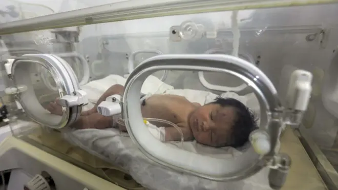 Photo of orphaned baby in hospital
