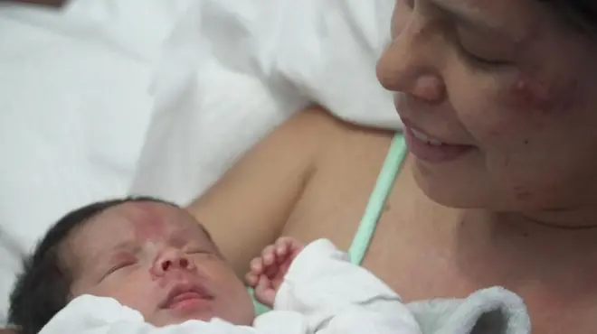 Dayana Patiño mira hacia abajo a su hijo Juan David, quien sonríe desde una cama de hospital en Caracas. Tanto la madre como el bebé presentan heridas en el rostro.